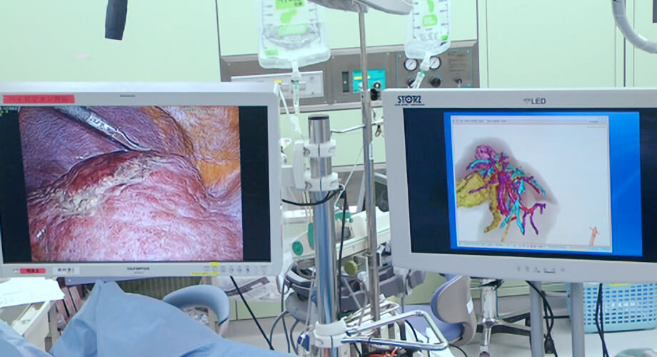 腹腔鏡手術：2次元バーチャルナビゲーション01